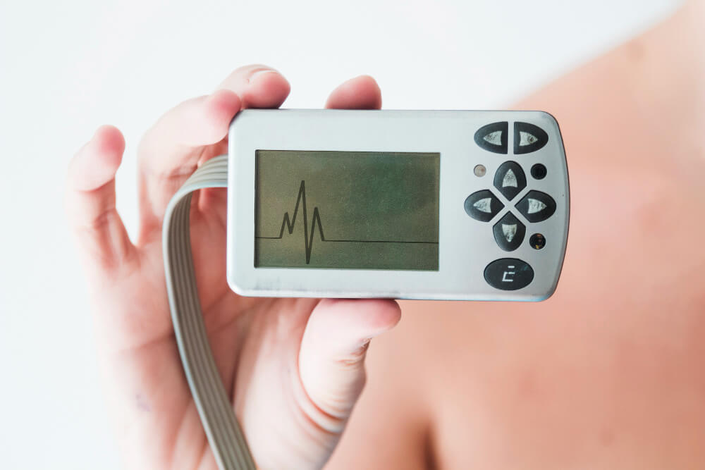 holter-monitor